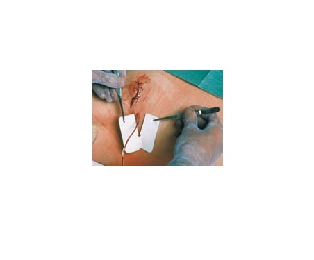 MEDICAZIONE PER TUBI DI DRENAGGIO FESSURATA METALLINE DRAIN 6X7CM FORO 4,5X11MM 50 PEZZI - Farmaunclick.it